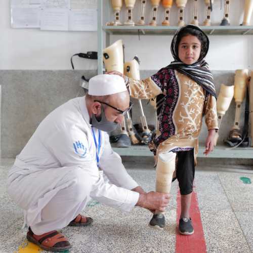 Ein kleines Mädchen bekommt ihre Bein-Prothese von einem Experten von Handicap International angepasst.